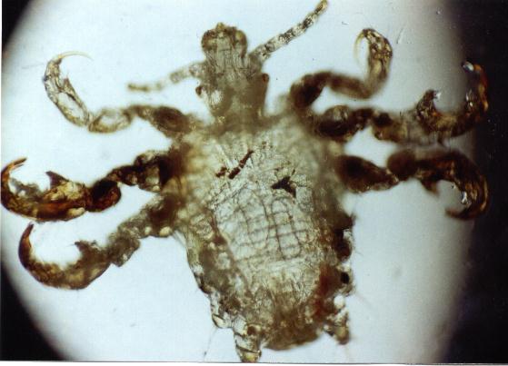 Download Pediculus pubis (559Wx403H)
